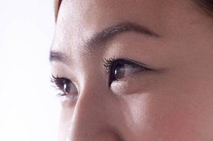 金沢市で評判の二重整形について