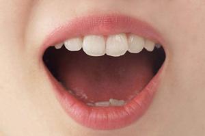 蒙古斑を解消するレーザー治療のすべて:効果、ケア方法、体験談まとめ