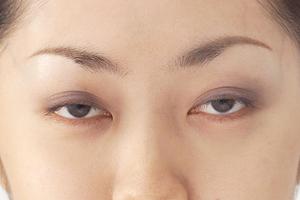 塩崎クリニックの婦人科形成手術とは