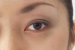 自然な「まぶた」を取り戻すアイリフト手術